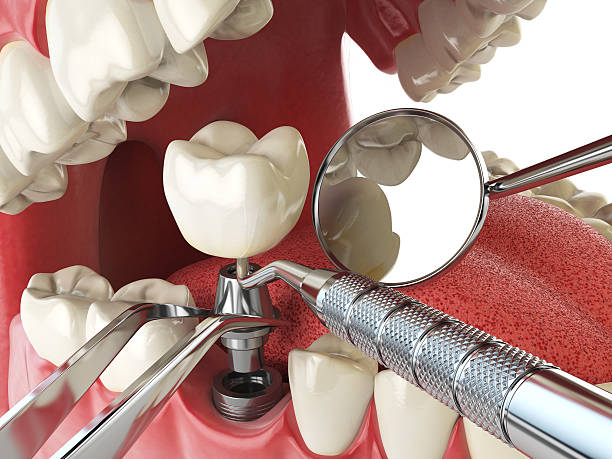 Tooth Infection Emergency Dentist in HI